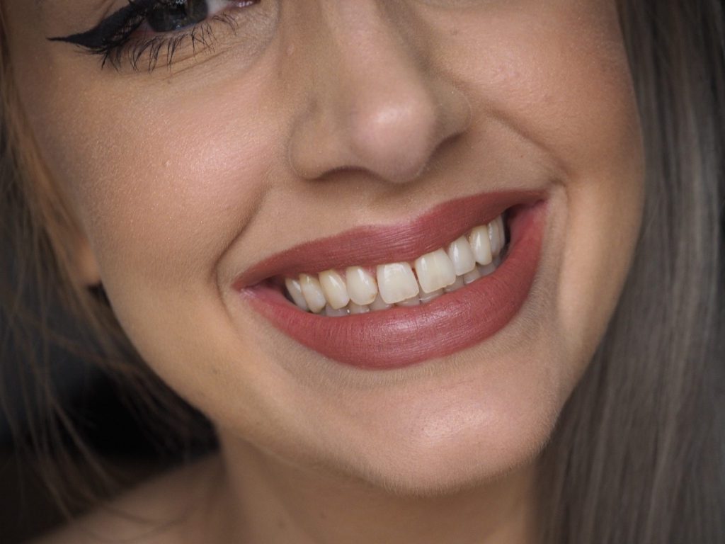 Laura Kate Lucas - Manchester Fashion, Beauty and Lifestyle Blogger | Smile brilliant Home Teeth Whitening Kit Review and Results