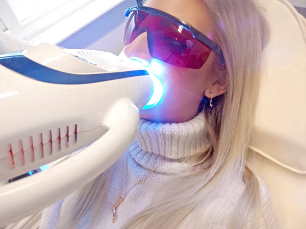 The White House Teeth Whitening Review Is it worth it? Laura Kate Lucas